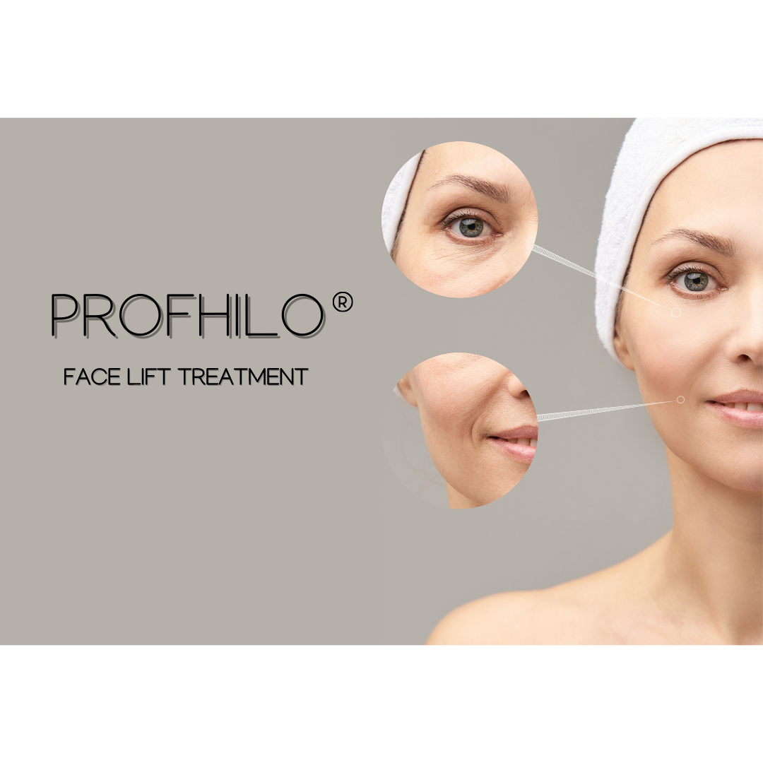 PROFHILO-FACE-LIFT